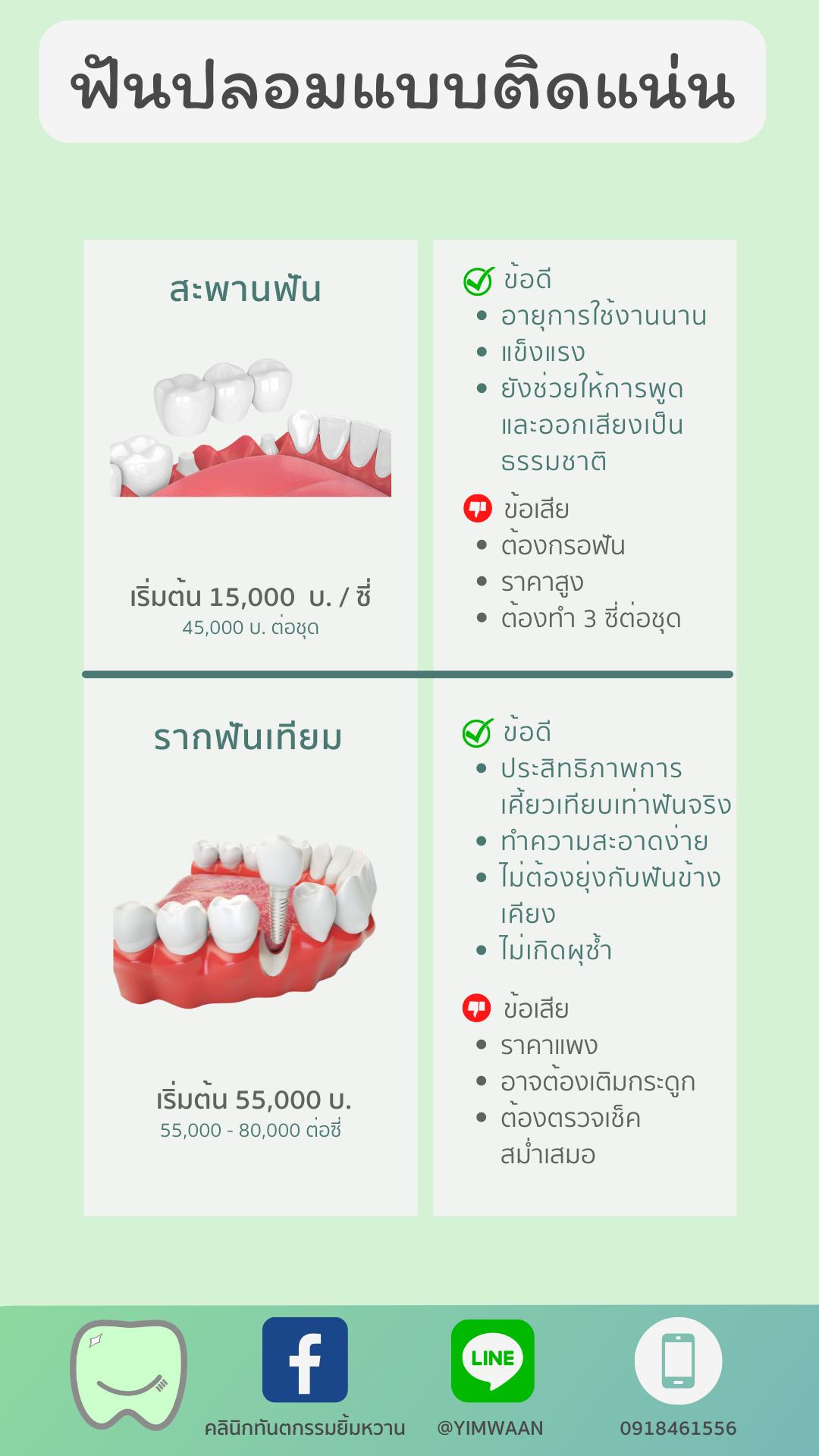 ฟันปลอมชนิดติดแน่น ข้อมูล
