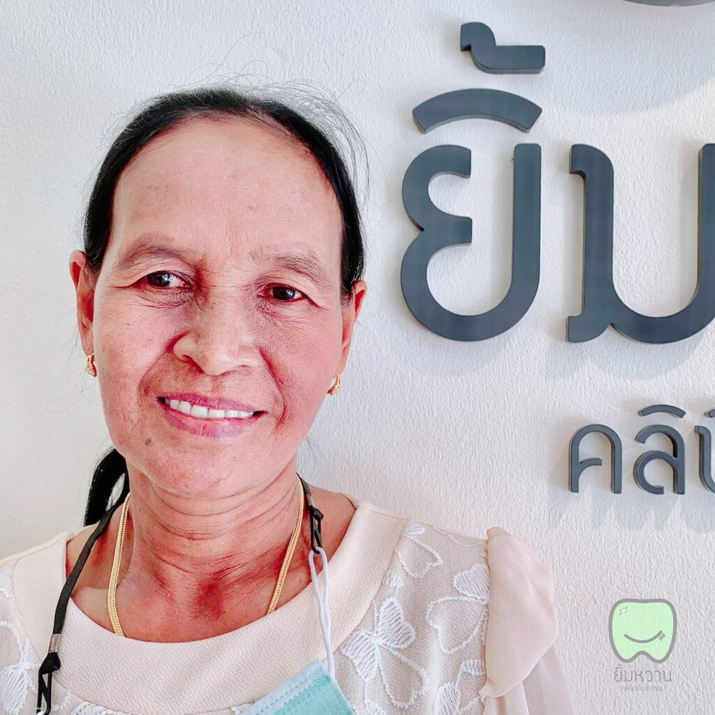 ผ่อนจ่ายค่าฟันปลอม