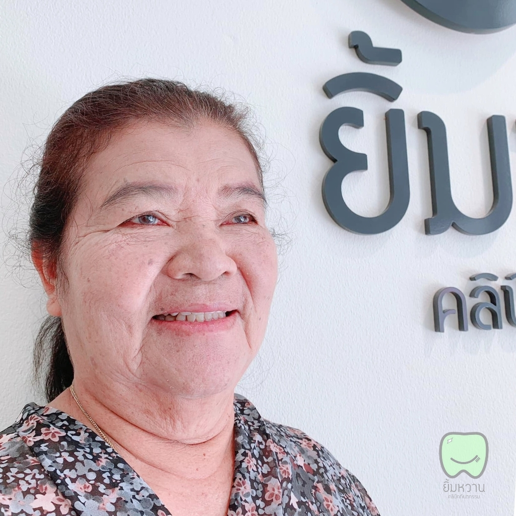 ผลการรักษาคลองรากฟัน